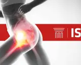 Silueta de corredor con zona de dolor en la cadera, indicando posible dolor al correr. Logo ISAF.